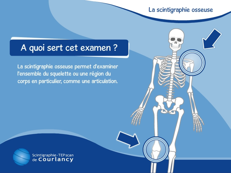 Scintigraphie Osseuse - L'examen de scintigraphie des os et ...